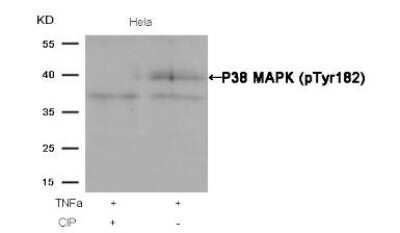 Western Blot: p38 alpha [p Tyr182] Antibody [NB100-82097]